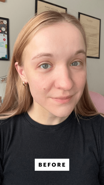 Herrick before applying the NuFace IonPlex HydraGel Power Patches